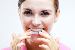 Tooth whitening kits pharmacy