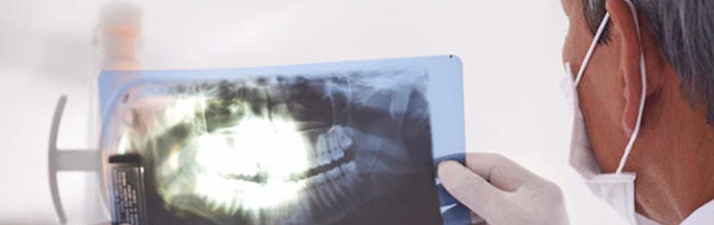 panoramic xray