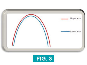 the arch width of a healthy bite