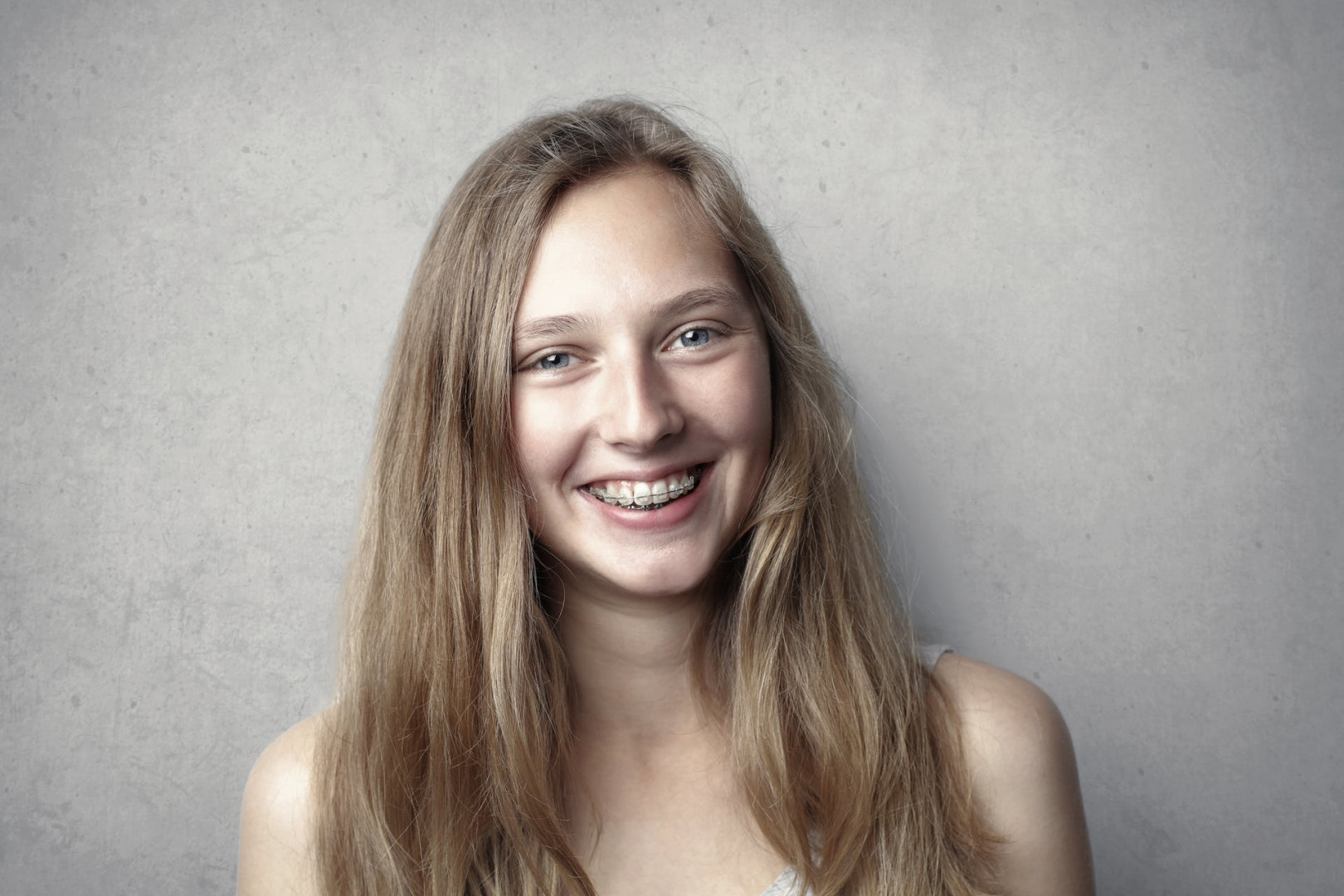 What Are the Best Braces for Adults?.