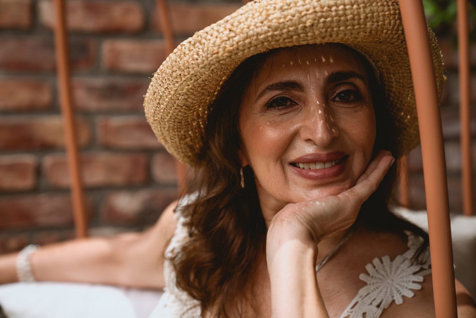 How Long Do Dental Implants Last?.