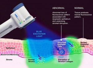 what you should know about oral cancer