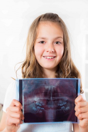 are dental x-rays safe