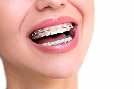 Adults should seek orthodontics as it can help with major dental issues