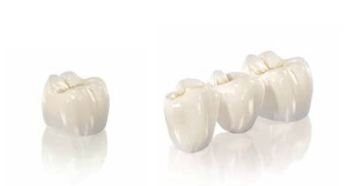 ceramic tooth crown