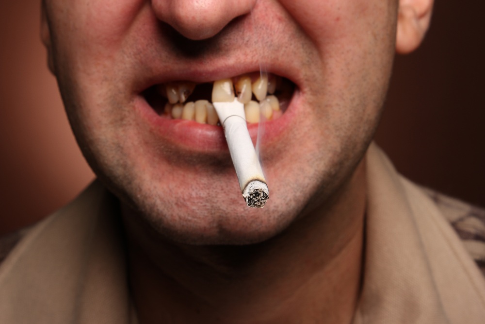 Smoker with bad teeth
