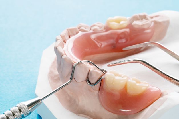 Different types of partial dentures