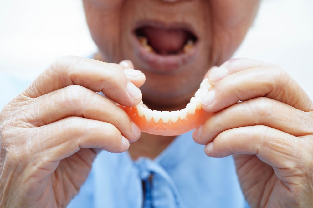 Inserting full lower denture