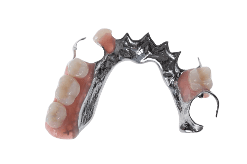 Chrome cobalt or metal frame partial denture