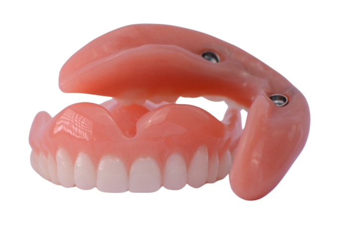 Implant retained denture in Tweed Heads