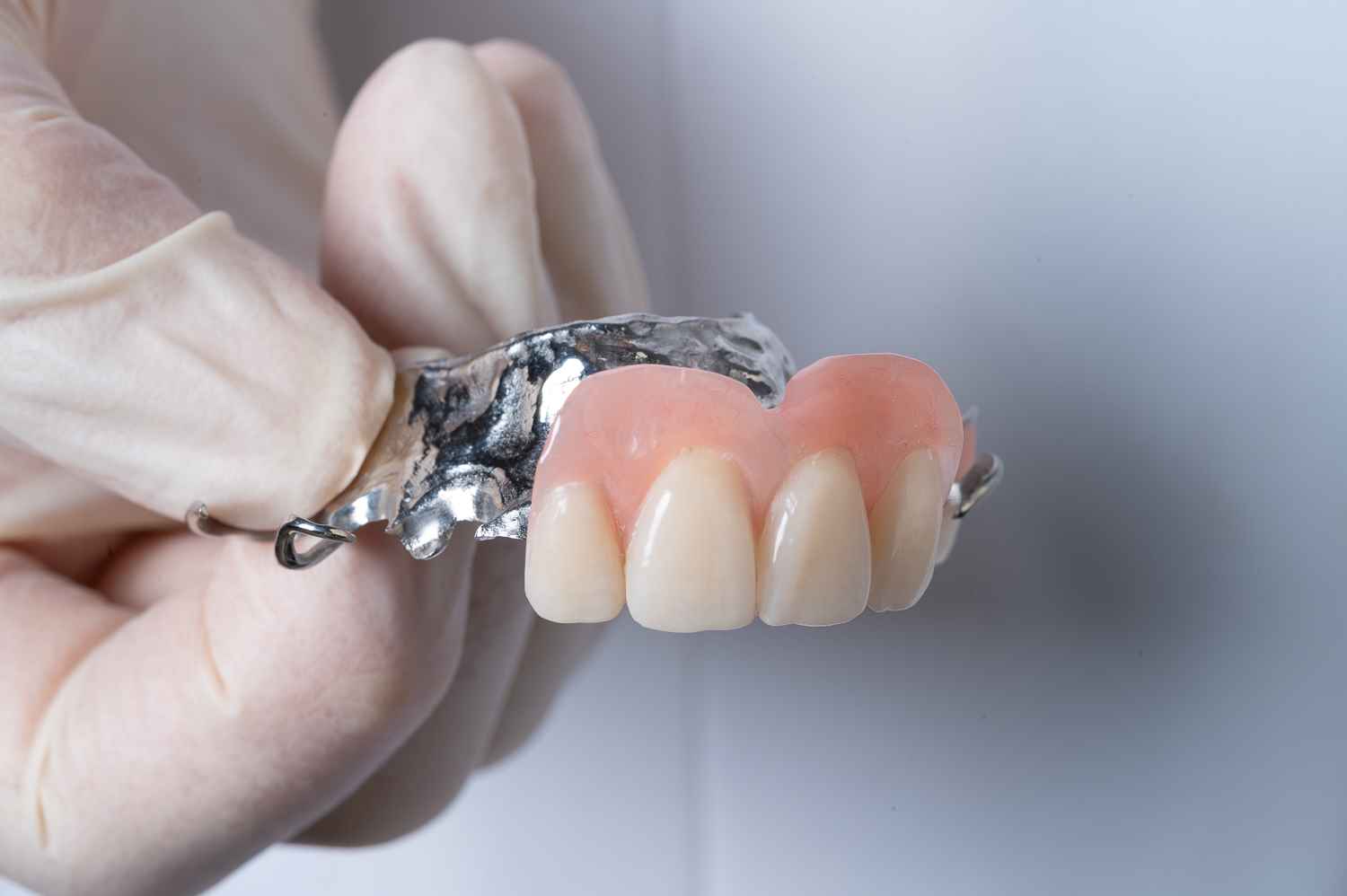 Chrome cobalt or metal frame partial dentures