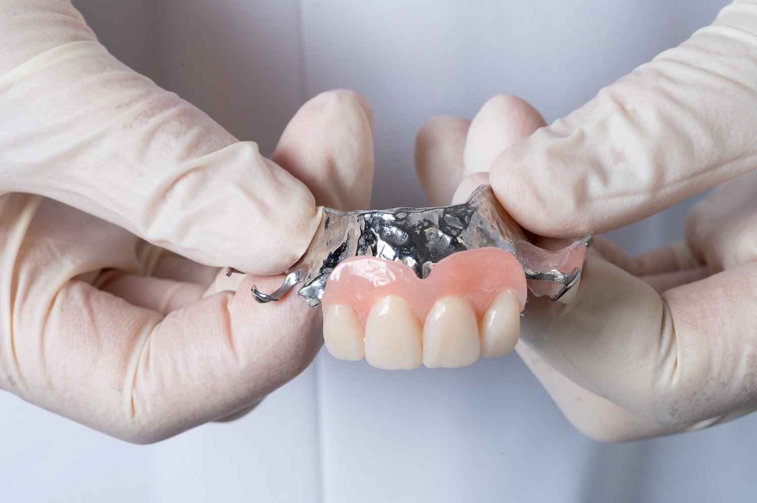 How much are partial dentures