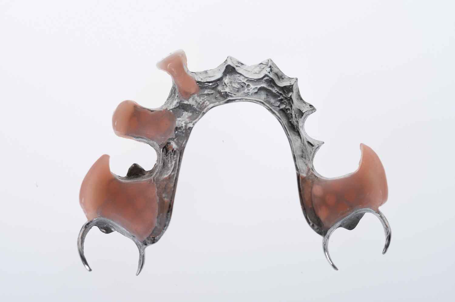 Chrome cobalt or metal frame partial dentures