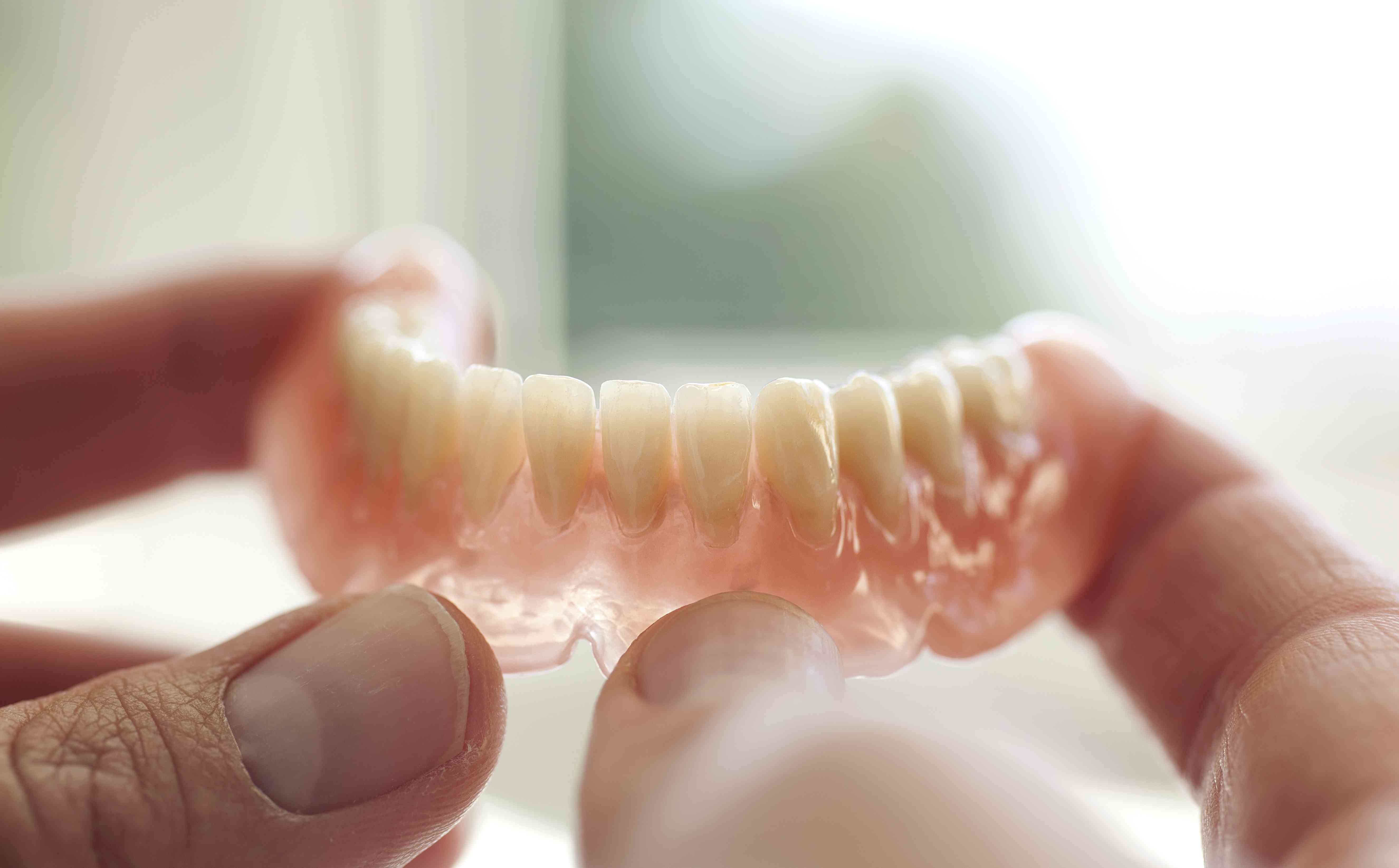 What is a denture reline?