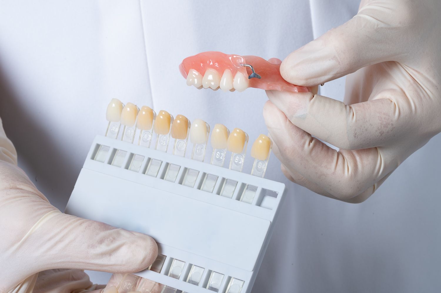 Tooth Addition to Partial Denture Tweed Heads | Same Day Service