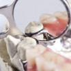 Chrome Dentures You Can Trust