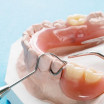Different types of partial dentures