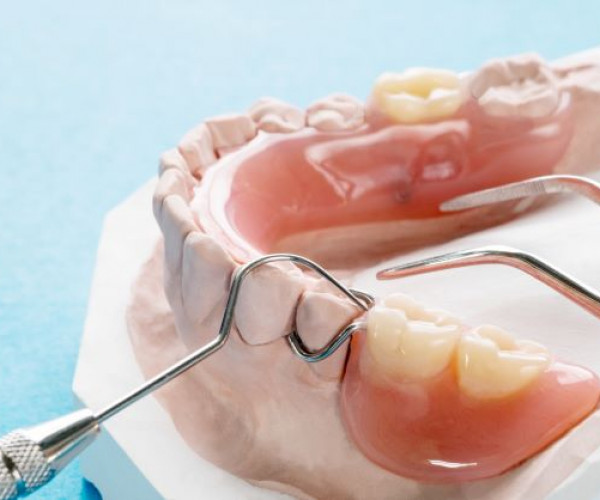 Different types of partial dentures.