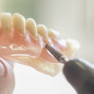 What is the process of getting dentures?
