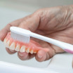 How to remove denture adhesive