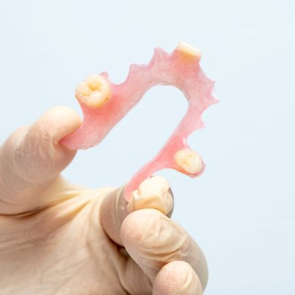 Partial flexible denture