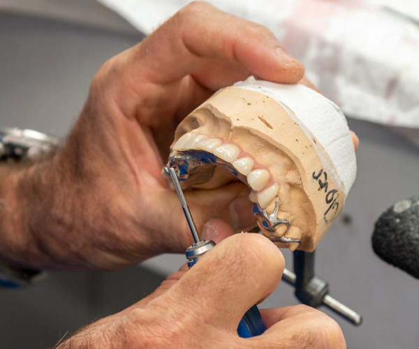 How long does it take to make dentures?.