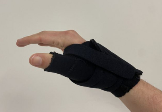 A simple mix of treatments holds the key to better hand function.