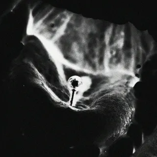 Exploited Body
