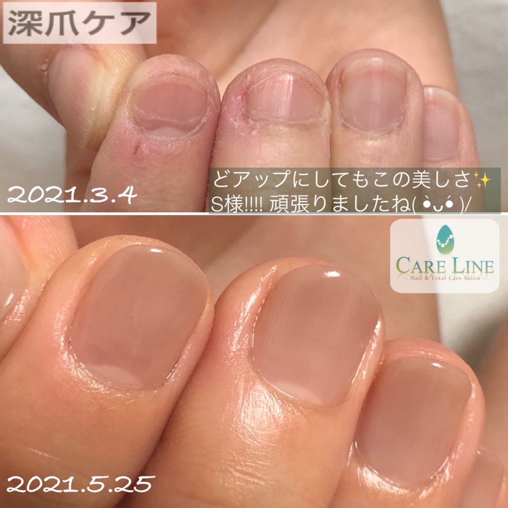 ケアライン 熊谷 Lit Link リットリンク