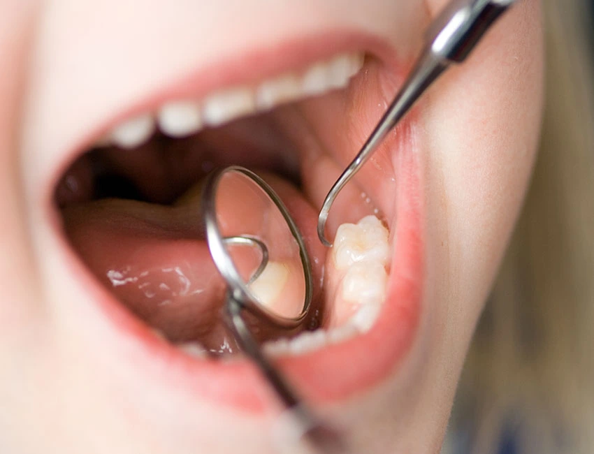 Dentist checking kids teeth at Discovery Children’s Dentistry & Orthodontics