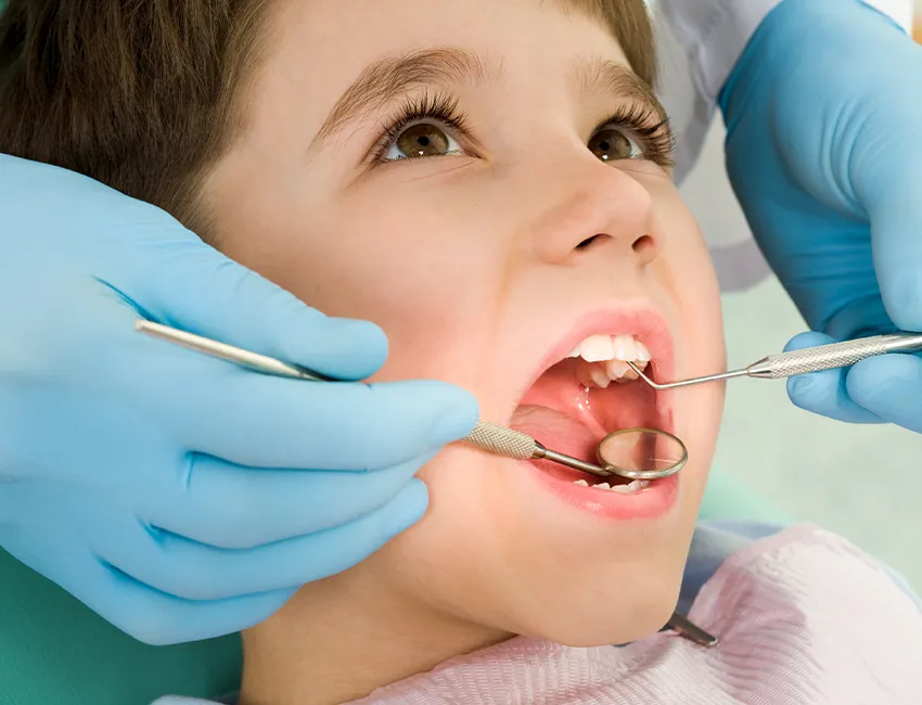 Kid getting sealant treatment at Elite Dentistry