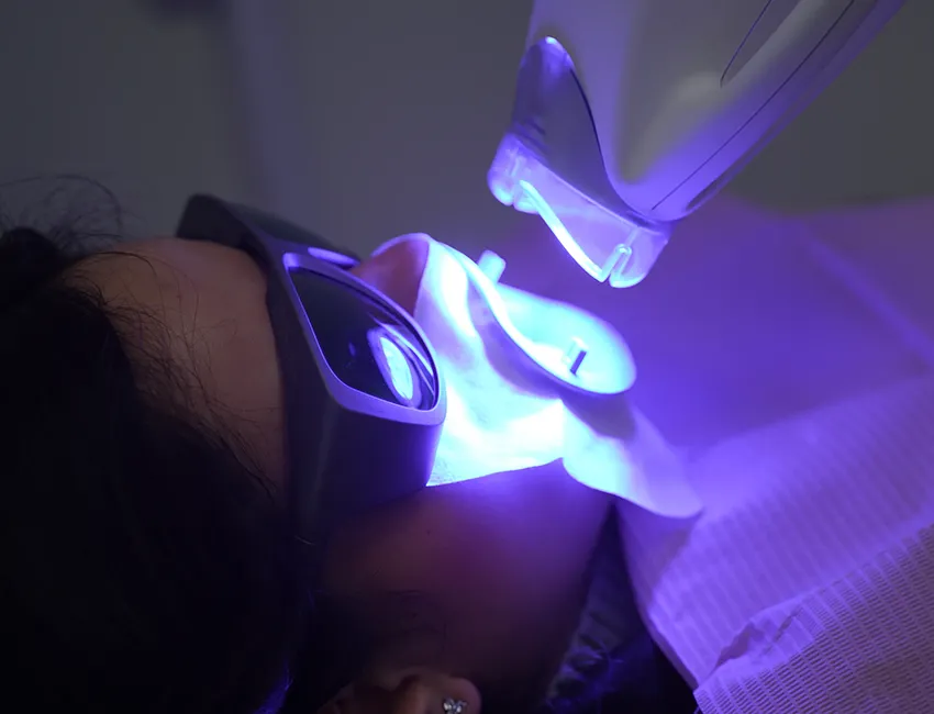 Patient choosing shade of teeth whitening color in Rancho Santa Margarita