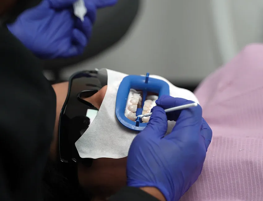 Patient with couple shade whiter tooth after teeth whitening treatment