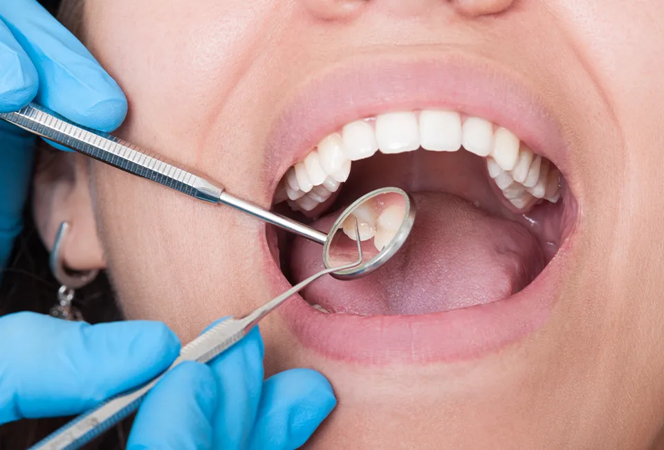 Patient getting dental checkup before cleaning
