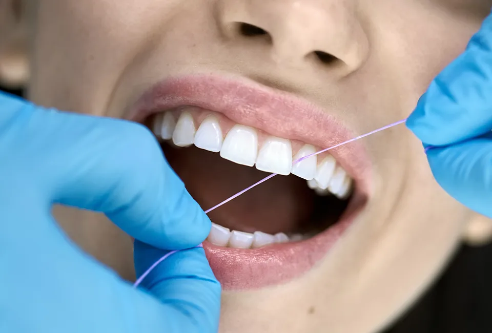 Teeth cleaning and flossing in Woodland Hills, CA