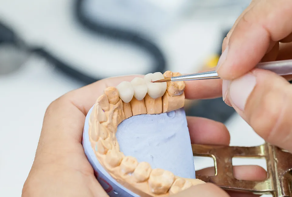 Dental Crown