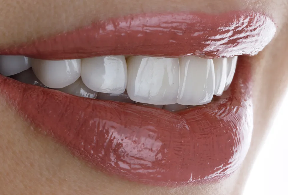 Patient flawless smile