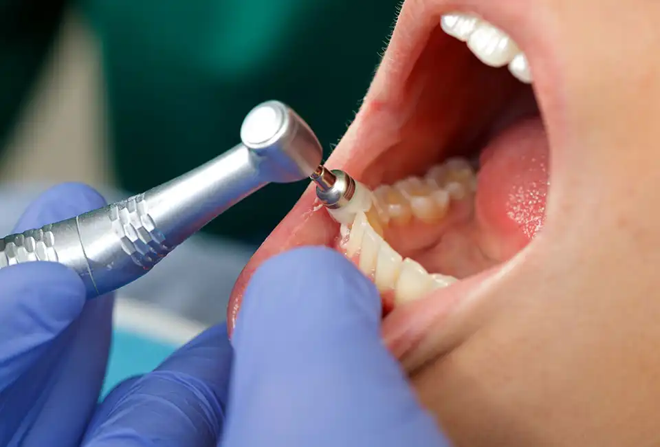 Teeth cleaning