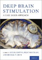 Book Cover for Deep Brain Stimulation by Shilpa (Associate Professor, Associate Professor, The University of Texas Southwestern Medical Center at Dallas) Chitnis