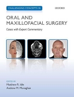 Book Cover for Challenging Concepts in Oral and Maxillofacial Surgery by Matthew R Specialist Registrar in Oral and Maxillofacial Surgery, Specialist Registrar in Oral and Maxillofacial Surger Idle