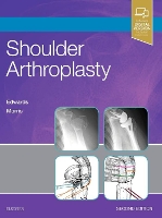Book Cover for Shoulder Arthroplasty by T. Bradley (Clinical Instructor, Department of Orthopaedic Surgery, University of Texas Health Sciences Center at Hous Edwards