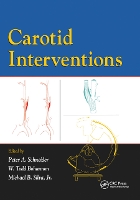 Book Cover for Carotid Interventions by Peter Schneider