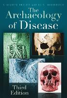 Book Cover for The Archaeology of Disease by Charlotte Roberts, Keith Manchester