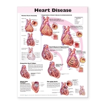 Book Cover for Heart Disease Anatomical Chart by Anatomical Chart Company