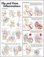 Book Cover for Hip and Knee Inflammations Anatomical Chart by Anatomical Chart Company