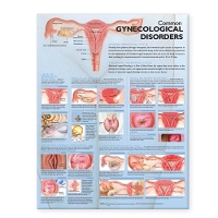 Book Cover for Common Gynecological Disorders Anatomical Chart by Anatomical Chart Company