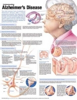 Book Cover for Understanding Alzheimer's Disease Anatomical Chart by Anatomical Chart Company