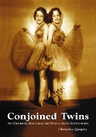 Book Cover for Conjoined Twins by Christine Quigley