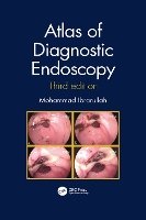 Book Cover for Atlas of Diagnostic Endoscopy, 3E by Mohammad Ibrarullah