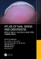 Book Cover for Atlas of Nail Signs and Disorders with Clinical and Onychoscopic Correlation by Nilton Hospital do Servidor Público Municipal de São Paulo, São Paulo, Brazil Di Chiacchio, Nilton Gioia Di Chiacchio, de Nak